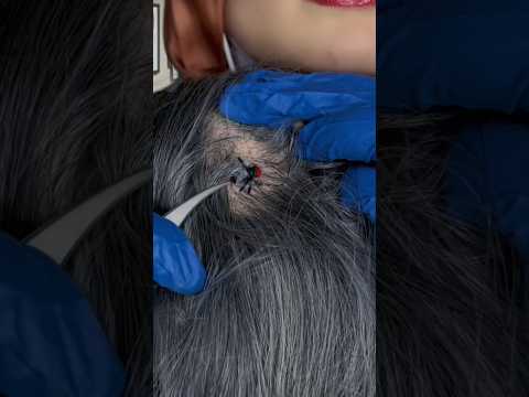 Bugs 🕷️ #asmr #satisfying #visualtingle # #mouthwhisper #relax