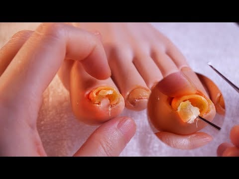 (NO BGM ver.) 😱 살을 파고든 내성발톱 양쪽 발 관리 + 각질, 보습 케어｜쿰쿰 관리실 상황극 ASMR