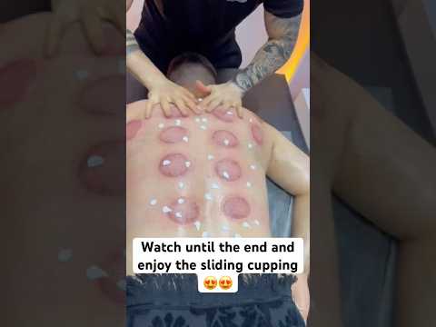 Woow😍❤️‍🔥#shortvideo #explore #shorts #asmr #cupping #cuppingtherapy #massage #youtubeshorts #fyp
