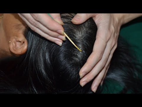 ASMR Nape Scratching, Scalp Scratching, Scalp Massage Relaxing For Sleep ( No Talking )