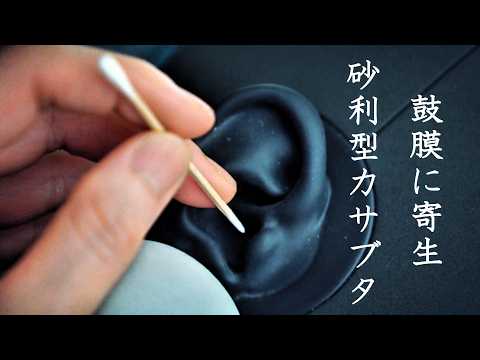 【ASMR KU100 無言】鼓膜の縁に寄生した砂利型カサブタ、増殖してるね。な、シチュエーション的耳掃除で処理 ｜ Pus-Mixed Gritty Scabs at the Eardrum Rim