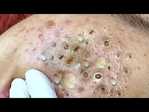 حلول طبيعية لبشرة صافية# 𝐒𝐤𝐢𝐧 𝐂𝐚𝐫𝐞 995510