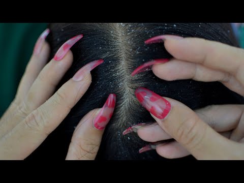 ASMR Dandruff Scratching Fast And Aggressive 1 Hour With Long Nails Relaxing For Sleep / No Talking
