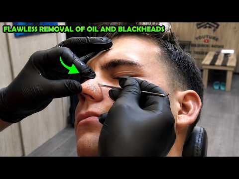 💈 I REMOVED OIL AND ACNE FROM HIZ FACE + HAIRCUT & RAZOR BEARD SHAVE + ASMR Deep Sleep Massage
