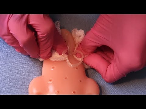 ASMR: ESPREMENDO CRAVOS E ESPINHAS #2 Popping Squeeze