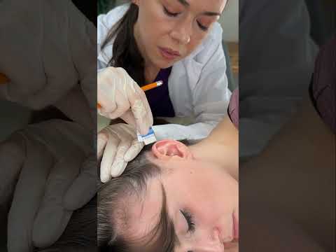 Asmr scalp tingles #asmr #asmrsounds #asmrvideo #relax #relaxing #satisfying #hair #sleep #tingles
