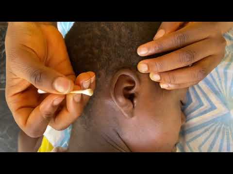 Asmr head massage  fast and aggressive MASSAGE YOUR SCALP TO MAKE YOU SLEEPY IN MINUTES