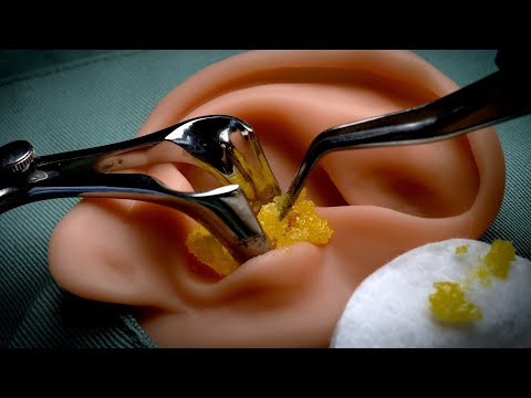 ASMR Roleplay to open ears and remove earwax with special equipment [earpick, both ears]