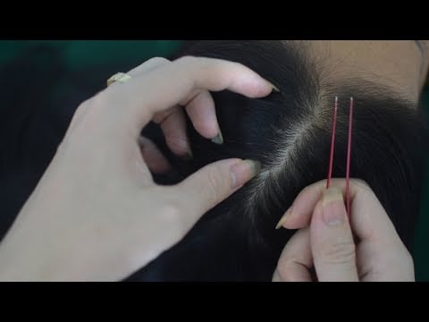 ASMR Hair Play, Hair Parting With Tweezers, Real Person Scalp Scratching Massage For Relaxation
