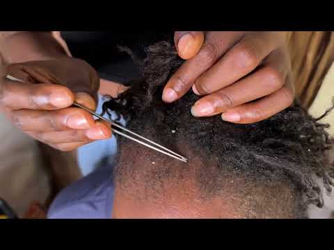 asmr scalp scratching & nitpicking flakes | fast & aggressive scalp scratching with gum chewing
