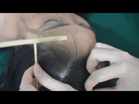 ASMR Nape Scratch, Scalp Scratching Sounds, Tingles Therapy For Relieve Stress, Headache