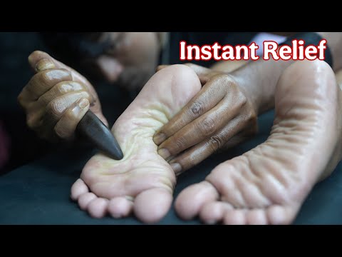 Therapeutic Foot Massage ASMR: Pressure Point Release for Instant Pain Relief #legmassage #asmr