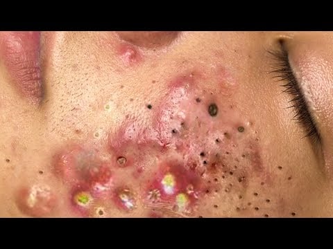 حلول طبيعية لبشرة صافية# 𝐒𝐤𝐢𝐧 𝐂𝐚𝐫𝐞 66894