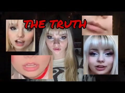 The Truth About My Top Lip.....