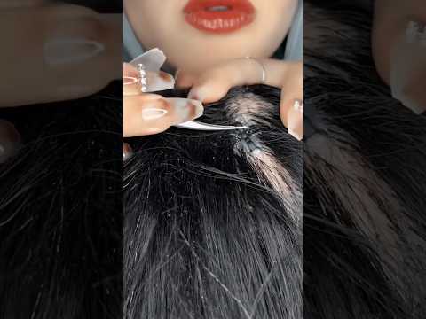 Bugs plucking 🐜🔍 #asmrmassage #asmrscratching #asmrvideo  #asmrscalpcheck #asmrmouthsounds #shorts