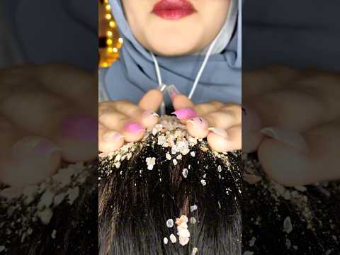 Dandruff removal 😱💆🏻‍♀️ #asmr #relaxing #visualtingle #asmrmassage #asmrscratching #shorts #viral