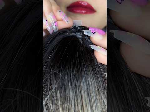 Bugs Plucking 🐜💆🏻‍♀️ #asmr #relax #visualtingle #satisfying #asmrmassage