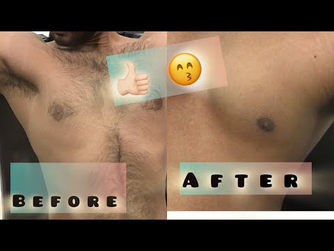 ASMR How to Trim Chest Hair and belly hair Pakistani style body Shave 💈Lahori Barber