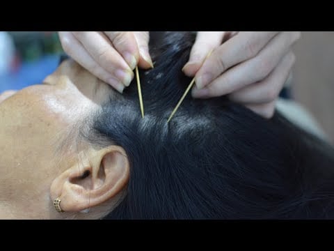 ASMR Scalp Check, Scalp Scratching With Toothpick On Real Person For Your Itchy Scalp ( No Talking )