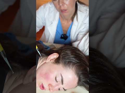 Asmr scalp 💆🏻‍♀️ #asmr #asmrsounds #asmrvideo #relax #relaxing #satisfying #hair #tingles #sleep