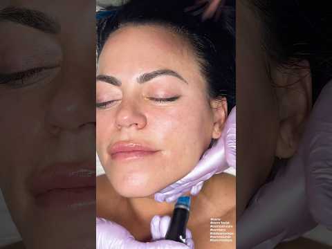 ASMR Hydrafacial