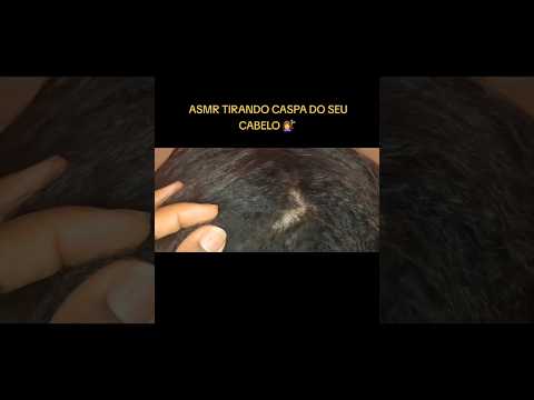 ASMR TIRANDO CASPA DO SEU CABELO #asmr #shorts #shortvideo #caspa