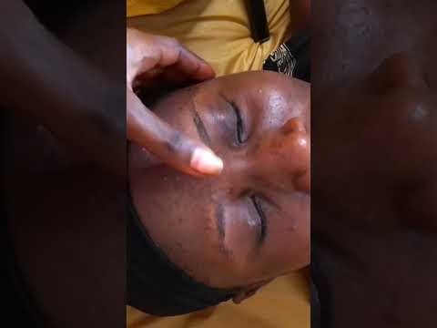 THE RELISHABLE FACE NITPICKING #satisfying #asmr #skincare