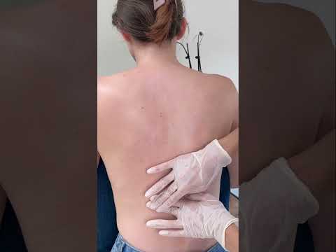 Asmr back exam #asmr #asmrsounds #asmrvideo #relaxing #relax #satisfying #satisfyingvideo #tingles