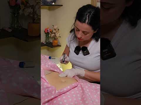 ASMR Abdomen Exam & Measuring