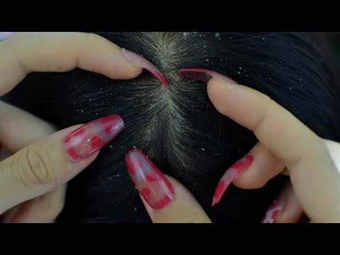 ASMR Dandruff Scratching And Picking Put You Into Deep Sleep / No Talking
