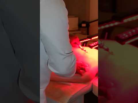 Electroacupuntura en un spa de Caracas 😳💉⚡️ #relax #massage #electroacupuncture #spa #short