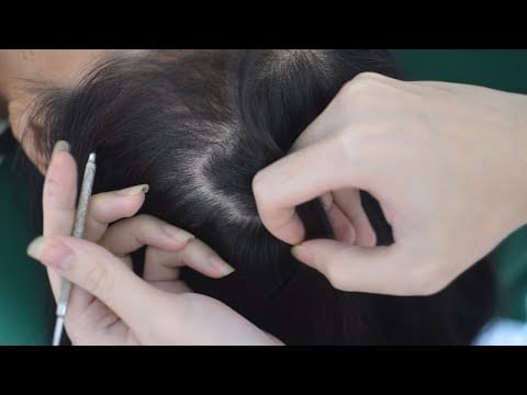 ASMR Nape Tingles, Scalp Scratching No Talking, Therapy Sounds For Relieve Anxiety, Stress