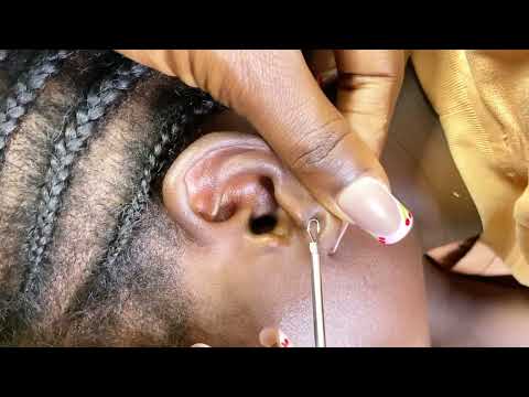 ASMR EAR CLEANING WITH BOBBY PIN FOR RELAXATION