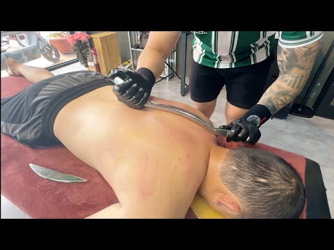 ASMR 🇻🇳 He Fixed My Neck & Shoulder Pain in Just 20 Minutes