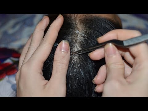 ASMR Real Person Scalp Check, Scalp Scratching Relax To Sleep