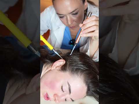 Asmr scalp 💆🏻‍♀️ #asmr #asmrsounds #asmrvideo #relax #relaxing #satisfying #hair #tingles #sleep