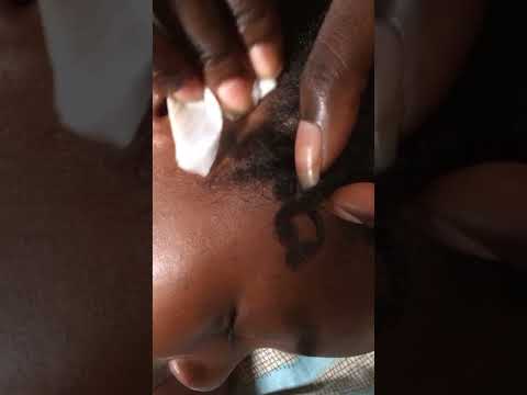 Asmr Nitpicking my baby to sleep #asmr #satisfying #nitpicking