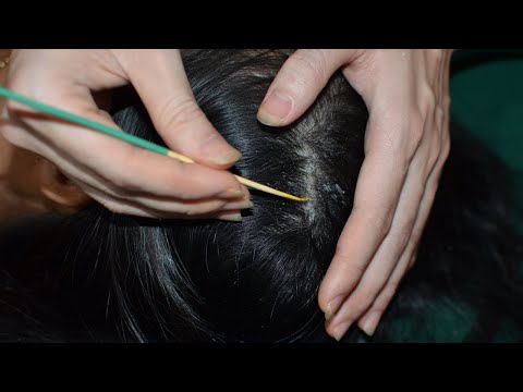 ASMR Scalp Check Relaxing For Sleep - Scalp Scratching Real Person ( No Talking )
