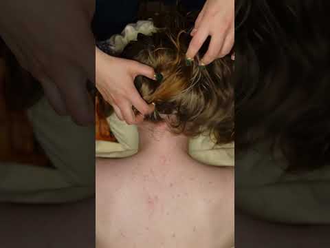 Crispy scalp massage asmr 😴