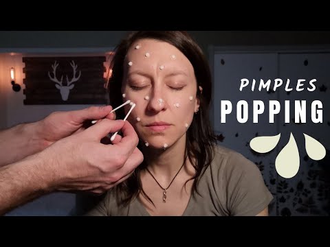 Real Person ASMR Giant Pimple Popping, No-Talking