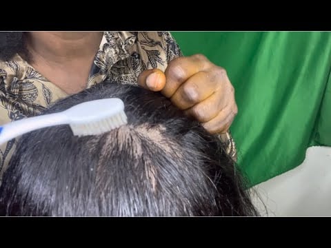 ASMR✨Scalp scratching, oiling and parting between scalp with bubblegum chewing sound. No talking.