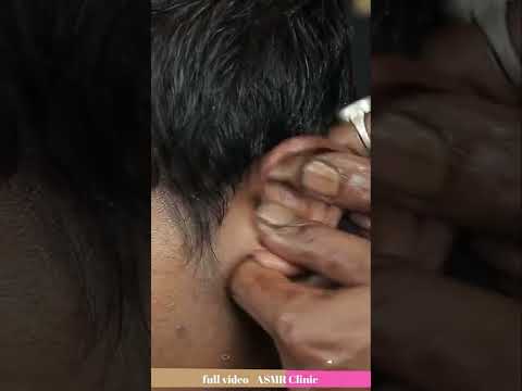 Satisfying Ear Massage With Neck Cracking Head Massage ASMR #shorts