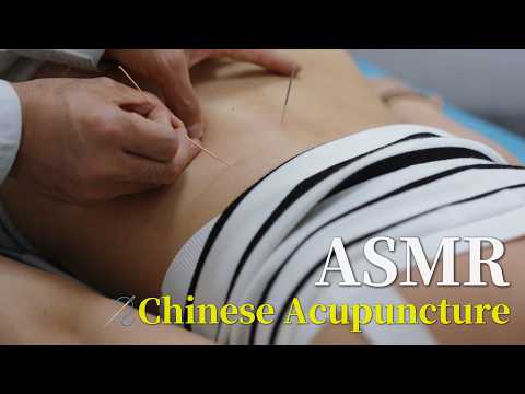ASMR🪡Chinese Acupuncture Immersive Vibes✨ Even iShowSpeed’s loving it! 🥱Relaxing & sleep-friendly!💤