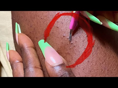 ASMR SUPER ATTENTIVE LEG NITPICKING