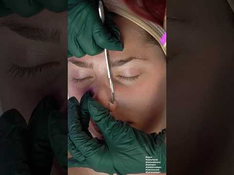 ASMR Facial | Dermaplaning