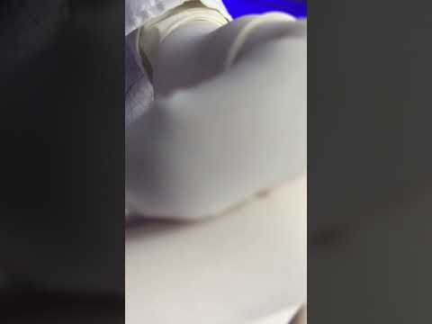 Cleaning your ear part 3