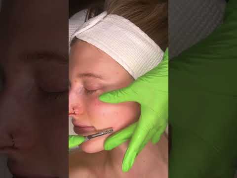 ASMR Mesmerizing Dermaplaning Treatment