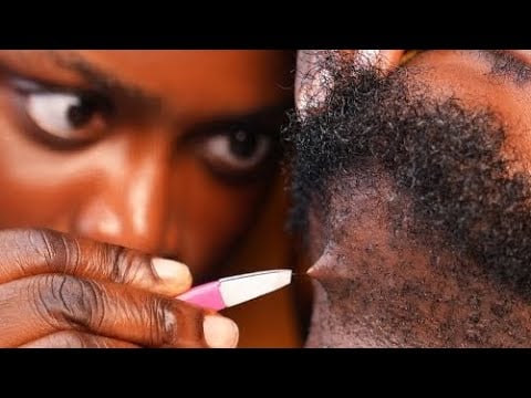 ASMR relaxing beard nitpicking,neck massage,soft gum  ingrown hair pullout, ear and nape massage 