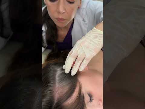 Asmr scalp tingles #asmr #asmrsounds #asmrvideo #relax #relaxing #satisfying #hair #sleep #tingles