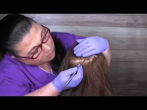 ASMR Scalp Check with Bad Results (Dandruff Removal, Scalp Treatment, Whispering) Medical Roleplay